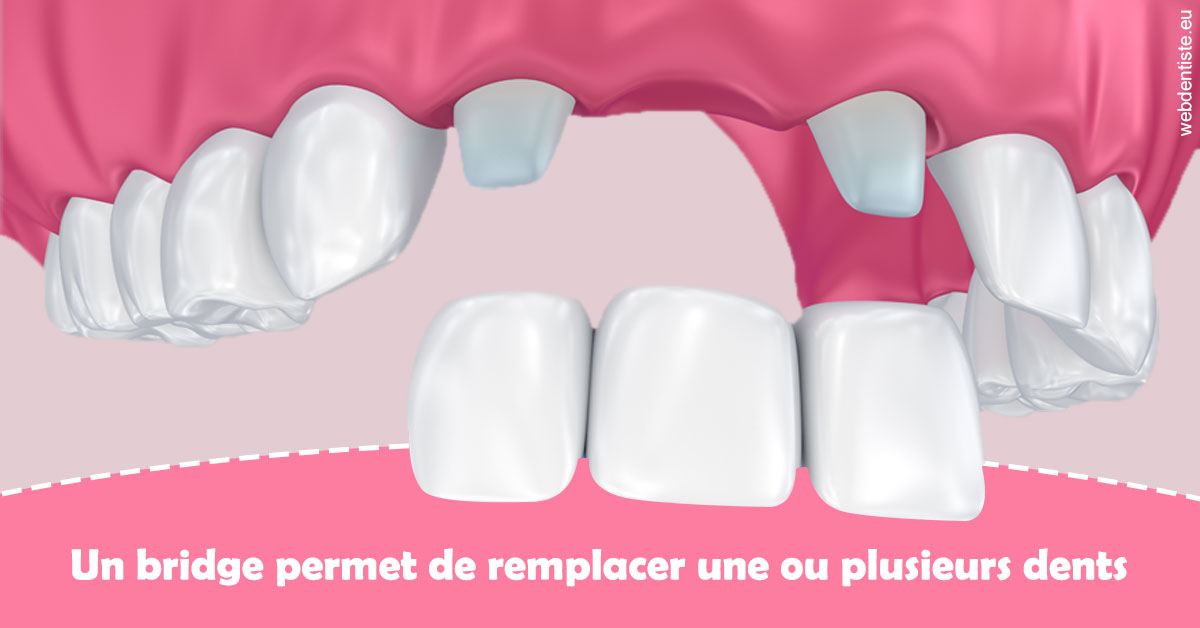 https://selarl-docteur-gilles-garnier.chirurgiens-dentistes.fr/Bridge remplacer dents 2