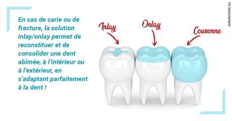 https://selarl-docteur-gilles-garnier.chirurgiens-dentistes.fr/L'INLAY ou l'ONLAY