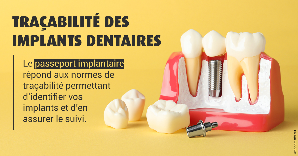 https://selarl-docteur-gilles-garnier.chirurgiens-dentistes.fr/T2 2023 - Traçabilité des implants 2