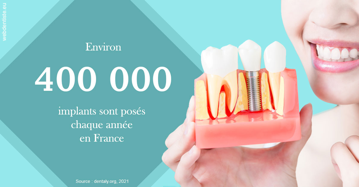 https://selarl-docteur-gilles-garnier.chirurgiens-dentistes.fr/Pose d'implants en France 2